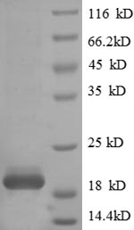 Human TRAC protein