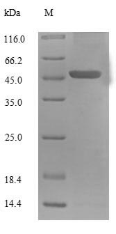 Human UCP1 protein