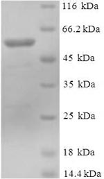 Human DCAF7 protein