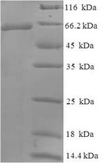 Human WT1 protein