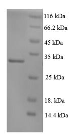 Human XPC protein
