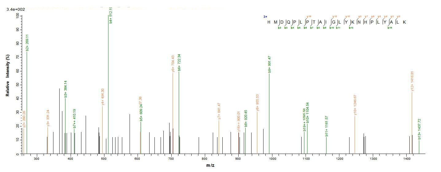 Human XPC protein