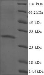 Human YPEL3 protein