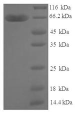 Human ZNF114 protein