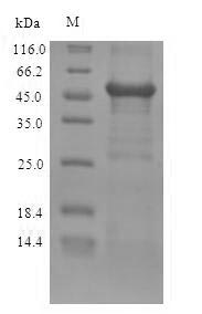 Human ZRANB2 protein