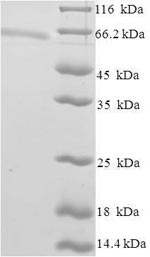 Human ZSCAN20 protein