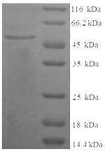 Human C4B protein