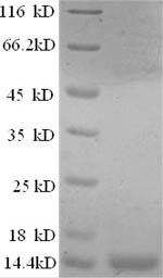 E.coli Con-ikot-ikot protein