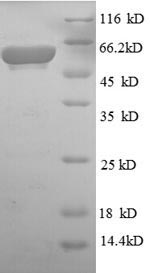 E. coli glpD protein