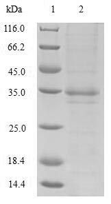 E.coli fim3 protein