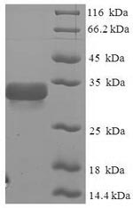 E.coli GM2S-1 protein
