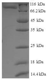 E.coli IFM1 protein