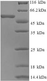 Human S protein