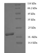 E.coli Car b 1 isoform 2 protein