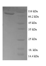 E. coli tktA protein