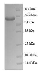 E.coli cyp125 protein
