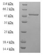 Human PNP protein