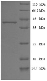 E.coli BALF5 protein