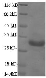 E.coli ptxA protein