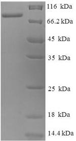 E.coli sacC protein