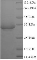 E. coli lptA protein