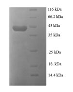 Human E2 protein