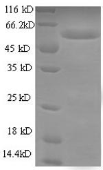 E. coli fimH protein
