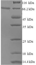 Human L2 protein
