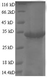 E.coli T7 Helix-destabilizing protein