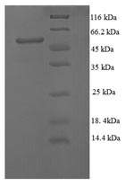 E. coli ecoRVM protein