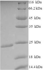 E. coli lolA protein