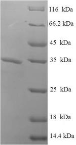 E.coli D LamSicTox-alphaIC1 protein