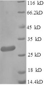 E.coli blaNDM-1 protein