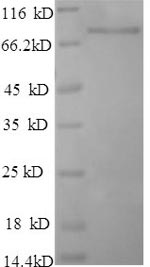 E.coli MRJP1 protein