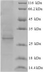 E.coli ORF3 protein