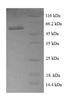 E. coli rpiA protein