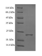 E. coli luxS protein