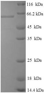 Viral A Intermediate capsid VP6 protein