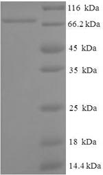 Human DHX9 protein