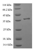 Human ICT1 protein