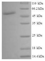Human GALE protein