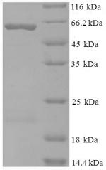Human CCBL1 protein