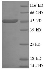 Human ELAVL3 protein