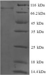 Human GCKR protein