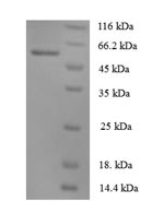Human ANGPT1 protein