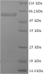 Human SMARCB1 protein