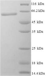 E.coli bglIIM protein