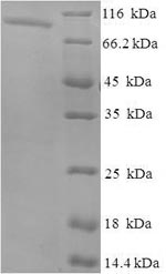 Human NAALADL2 protein