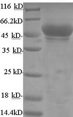 Mouse Hadh protein