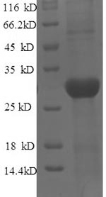 Mouse Jak3 protein